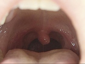 300人のおくち 第2集　サンプル画像04
